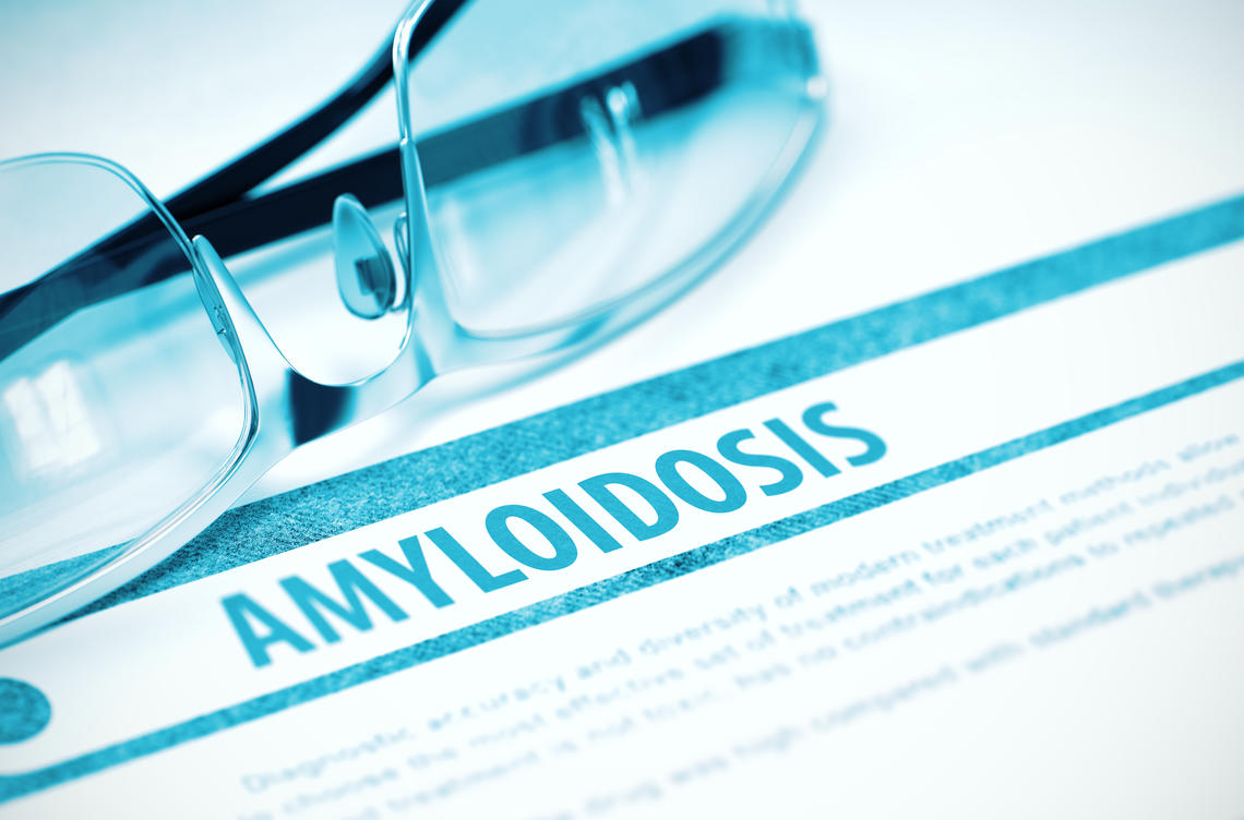 amyloidosis image