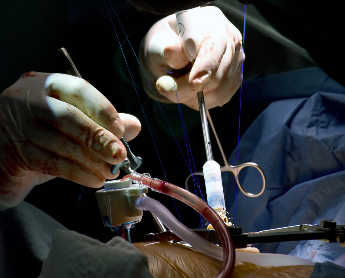close up of surgery