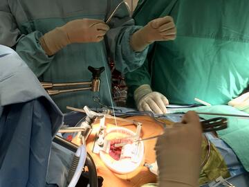 MICS surgery being performed